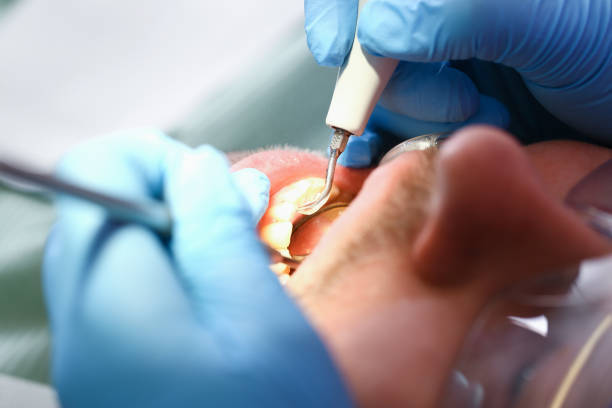 Best Emergency Treatment for Dental Infections or Abscesses in Evergreen Park, IL
